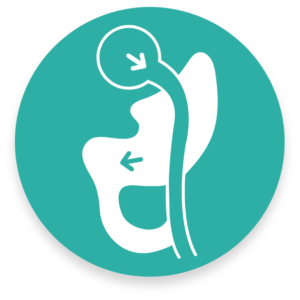 Icon showing small pouch created from the stomach and connected to the small intestine